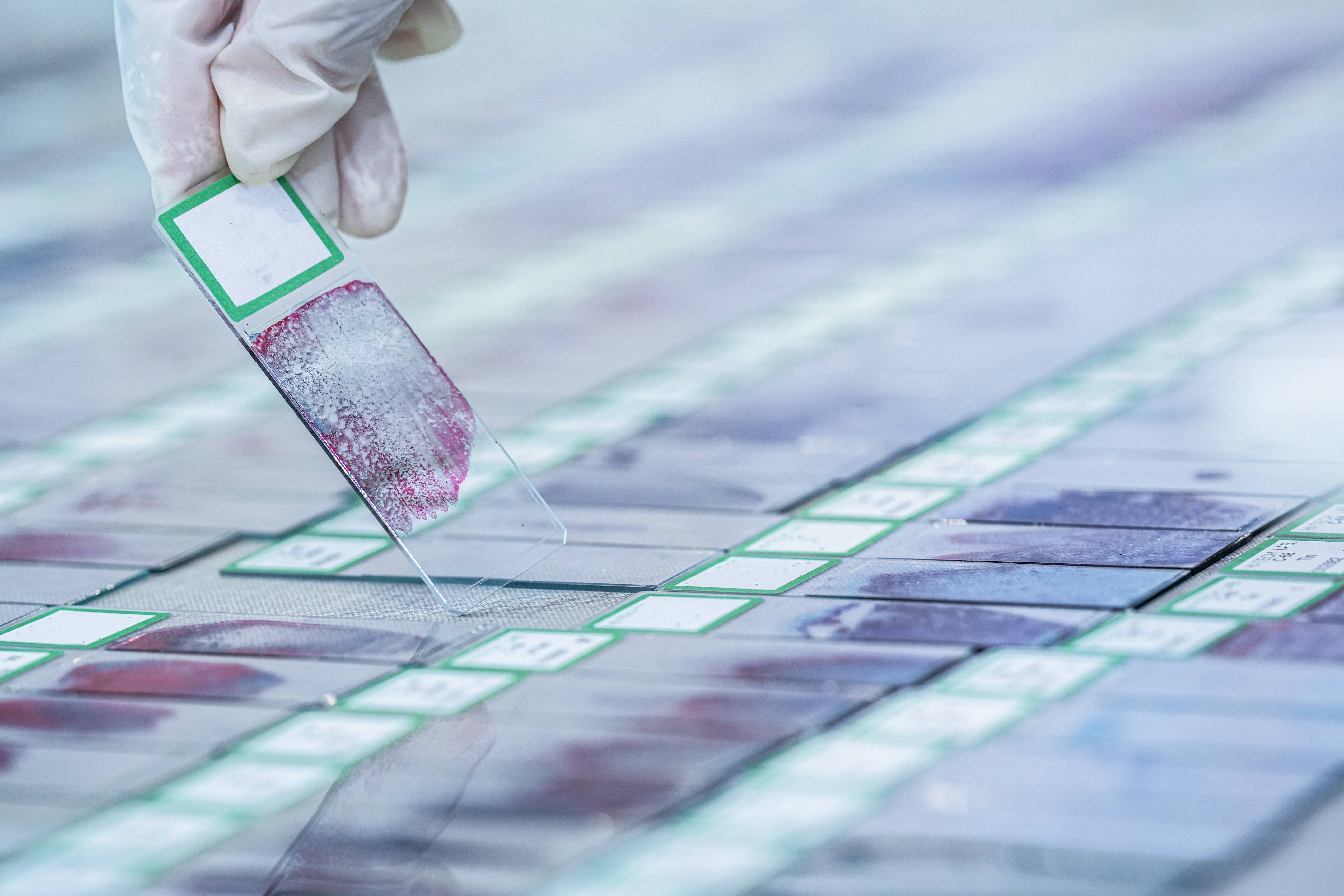 The Complete Guide to Microscope Slide Labeling